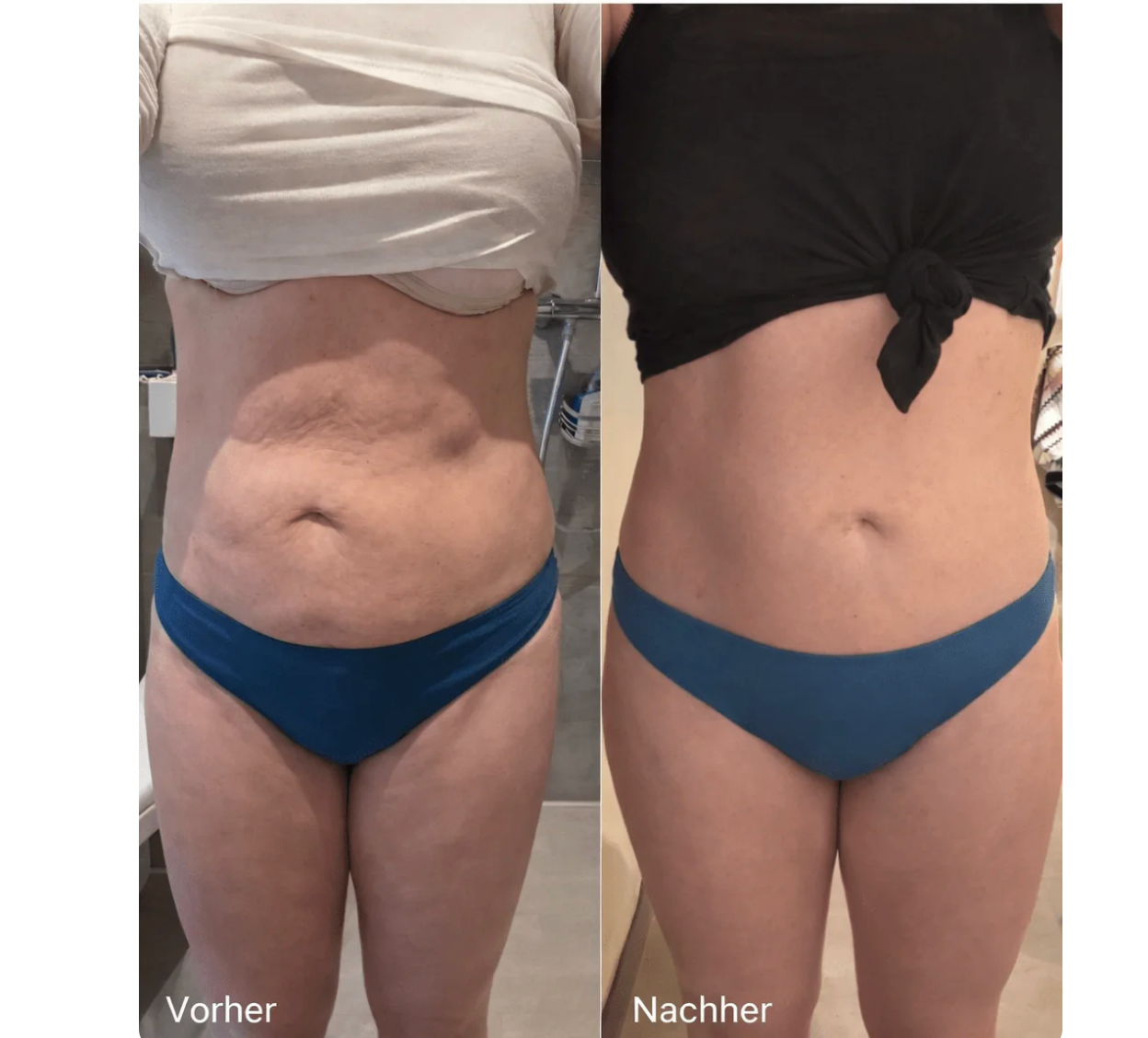 SkinContur - Glatte Haut in 14 Tagen